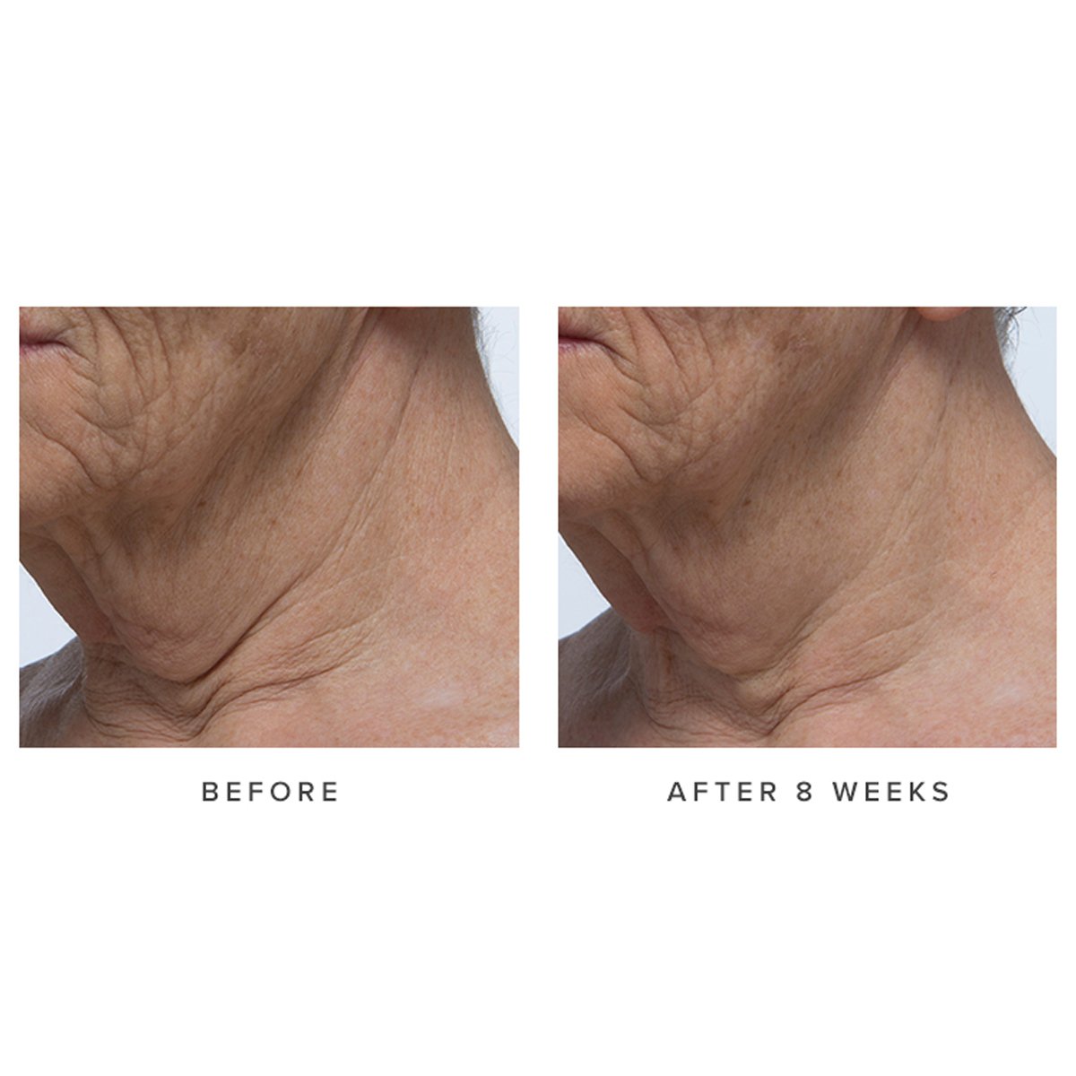 AgelessNeckCream-pdp-Clinicals-1200x1200_04d0d949-a4a4-4114-a759-9cbe0a910d8c.jpg