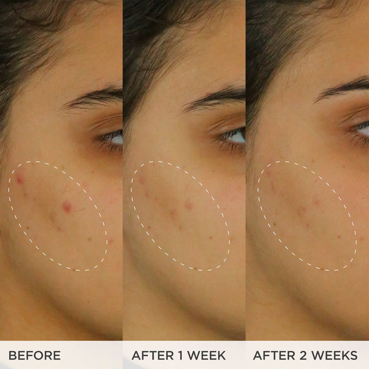 BrighteningSerum-pdp-Time-Comparison-1200x1200_a21c2df2-54c9-4564-b665-e3b99a62d1f6.jpg