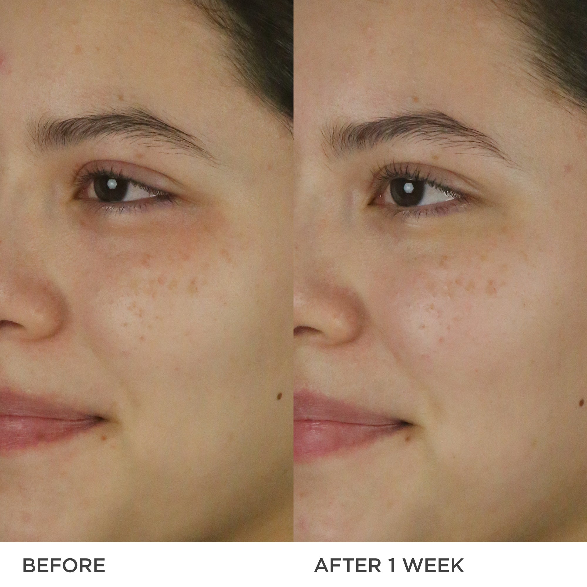 DewyMilk-pdp-Before-After-1200x1200_6b4159f1-88e0-4524-af22-19a136d81b43.jpg