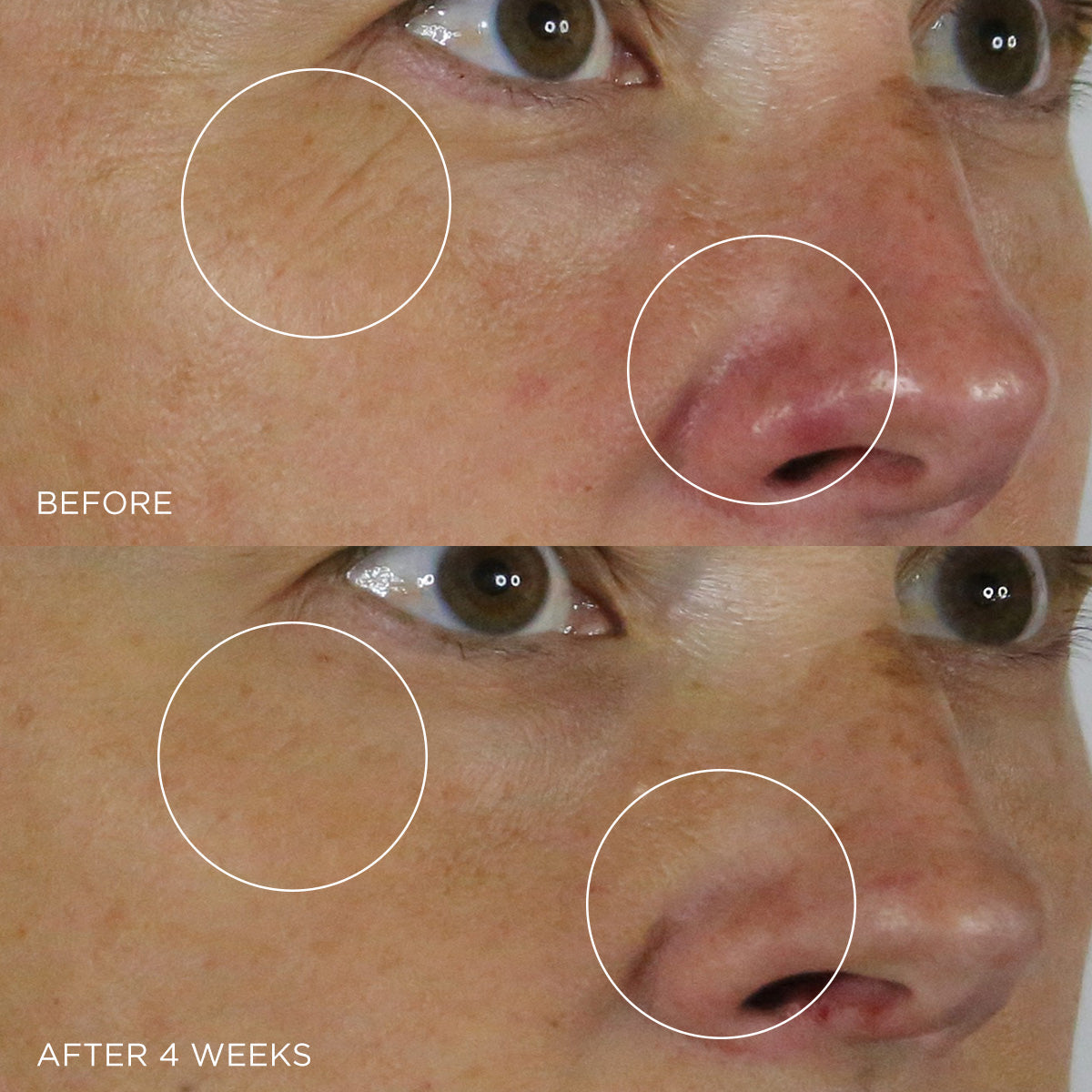 SilkSerum-pdp-BeforeAfter-1200x1200_12a99270-6320-4fc5-b21a-448515dab1de.jpg
